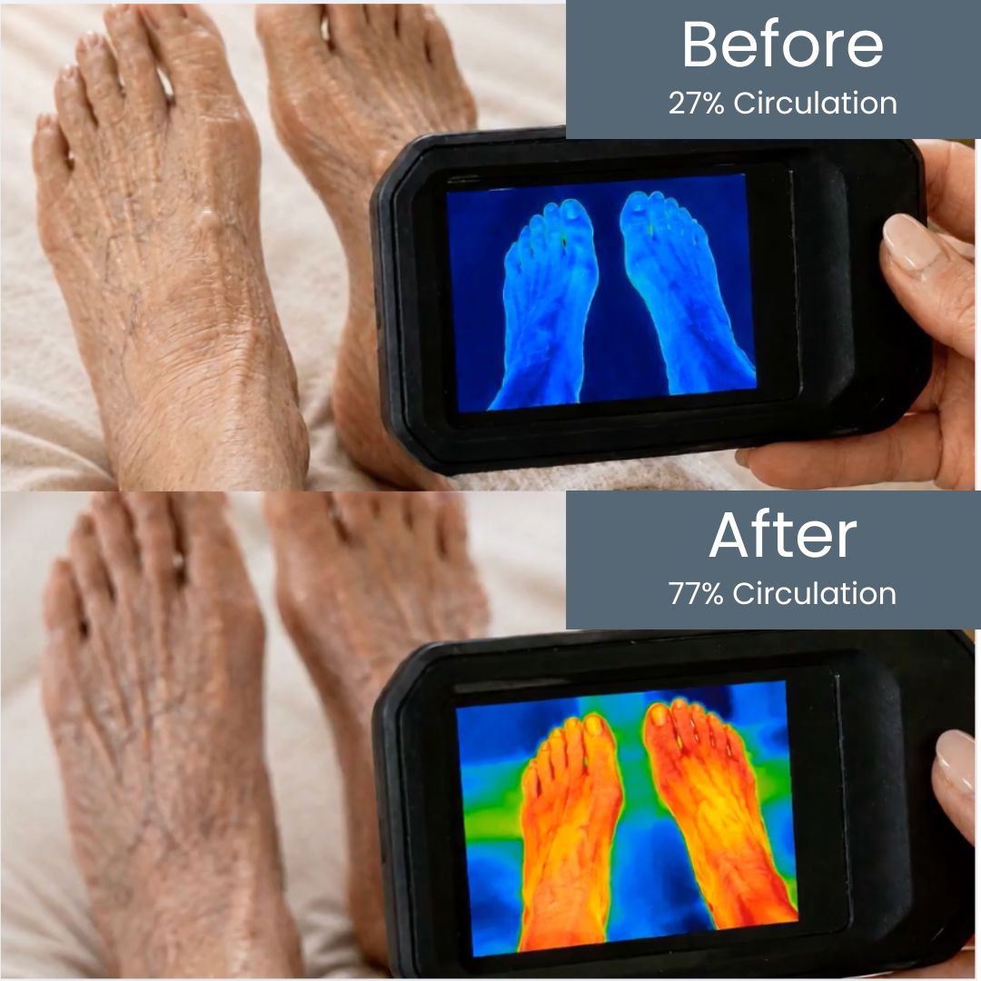 The Neuropathy Guy Nerve Cream